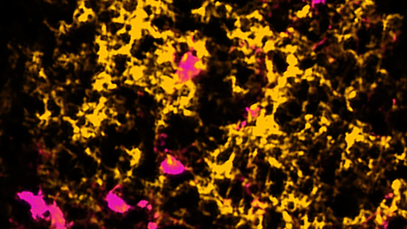 Microscopy of fibrinogen in the brain in yellow and magenta