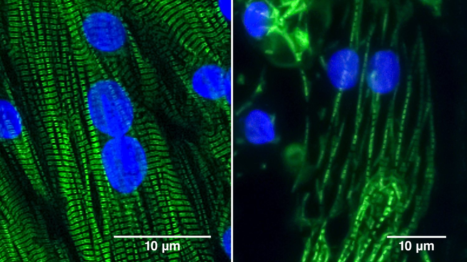 Two images showing heart muscle cells derived from normal human iPS cells, showing the difference between cells lacking the BAG3 protein