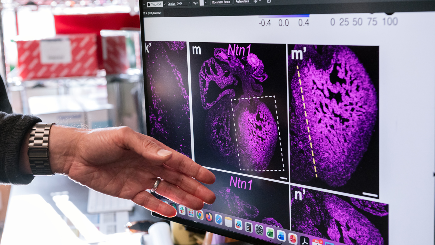 Data on a computer monitor in the Bruneau lab at Gladstone Institutes