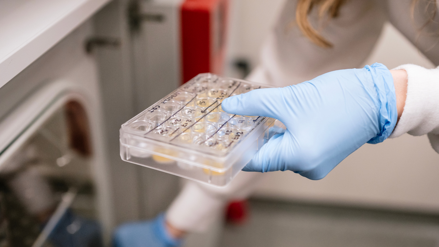 Close up of Maya Arce's hands, a scientist working in the lab at Gladstone Institutes