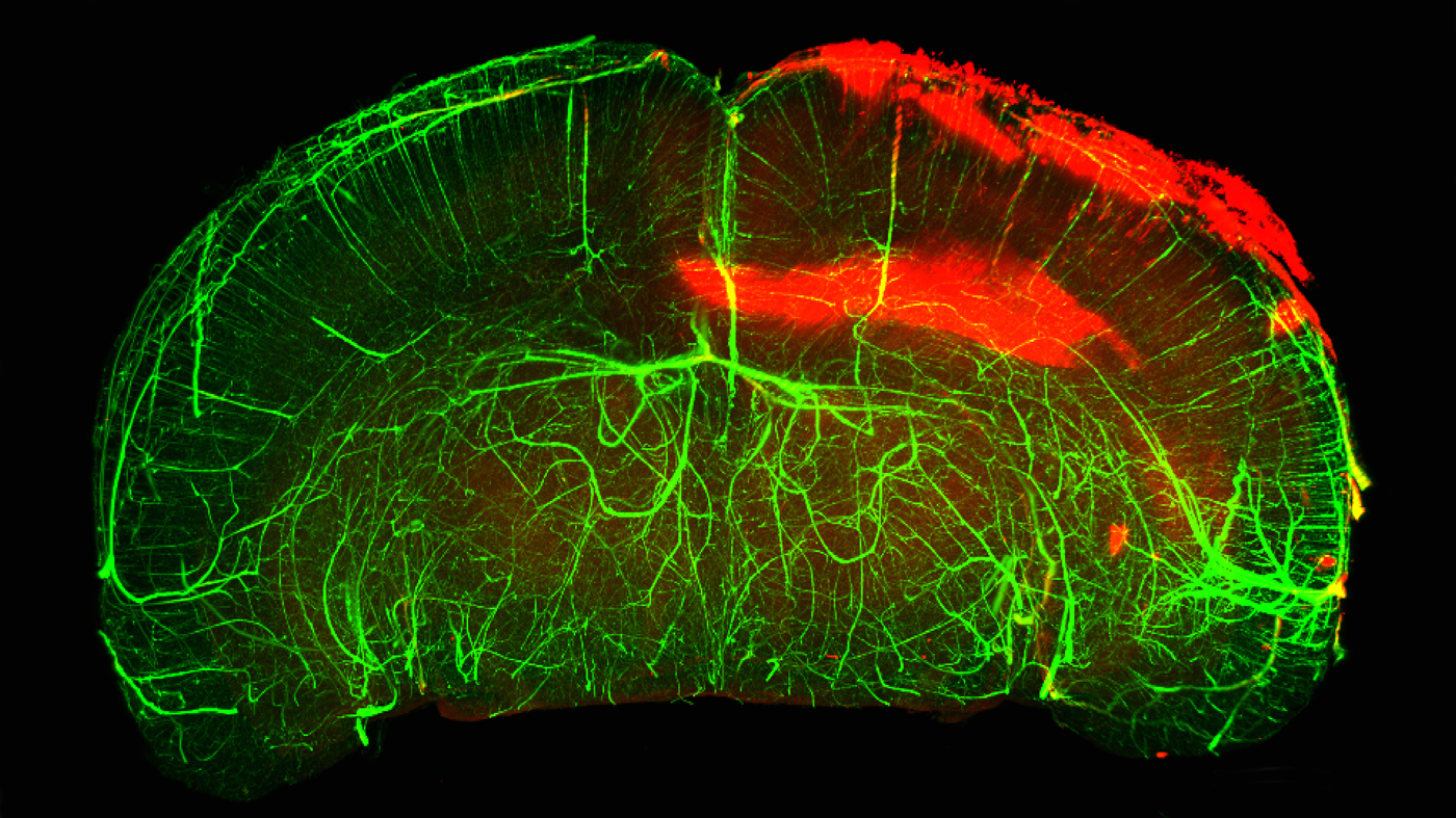 3D imaging of a mouse brain