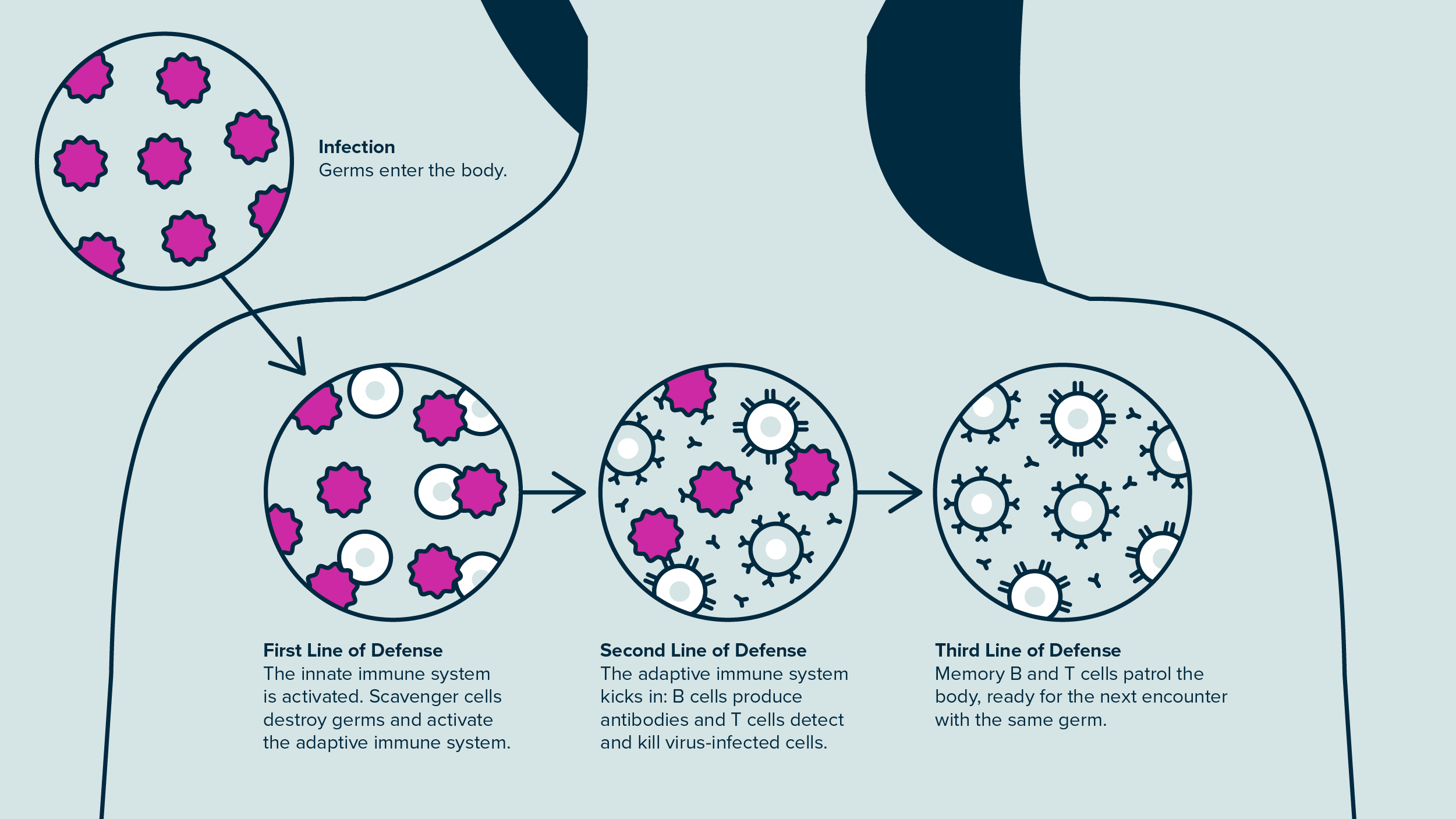 Infographic explaining how the immune system fights germs