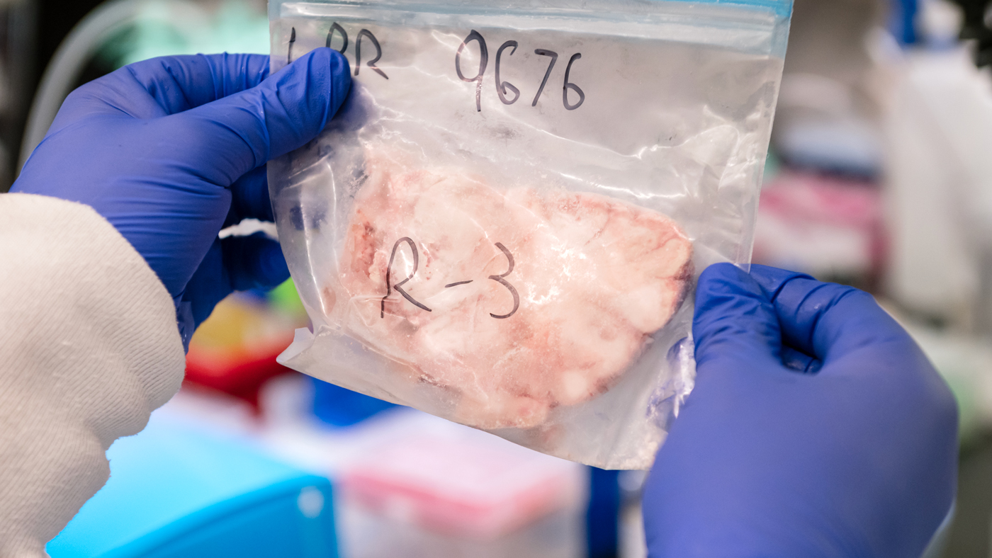 A frozen slice of human brain tissue in the lab at Gladstone Institutes