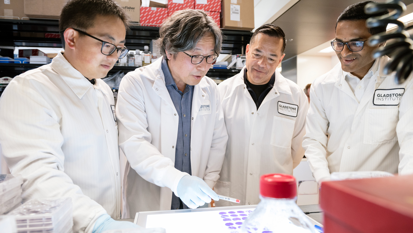 Gladstone scientists Zhaoqi Yan, Jae Ryu, Mauricio Montano, and Rahul Suryawanshi.