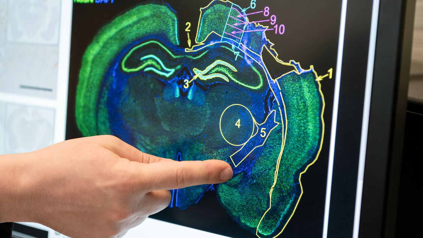 A monitor showing rat brain cells after stroke.